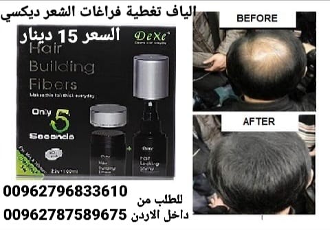 الحل الفوري للشعر الخفيف والصلع. والحل السريع والفعال