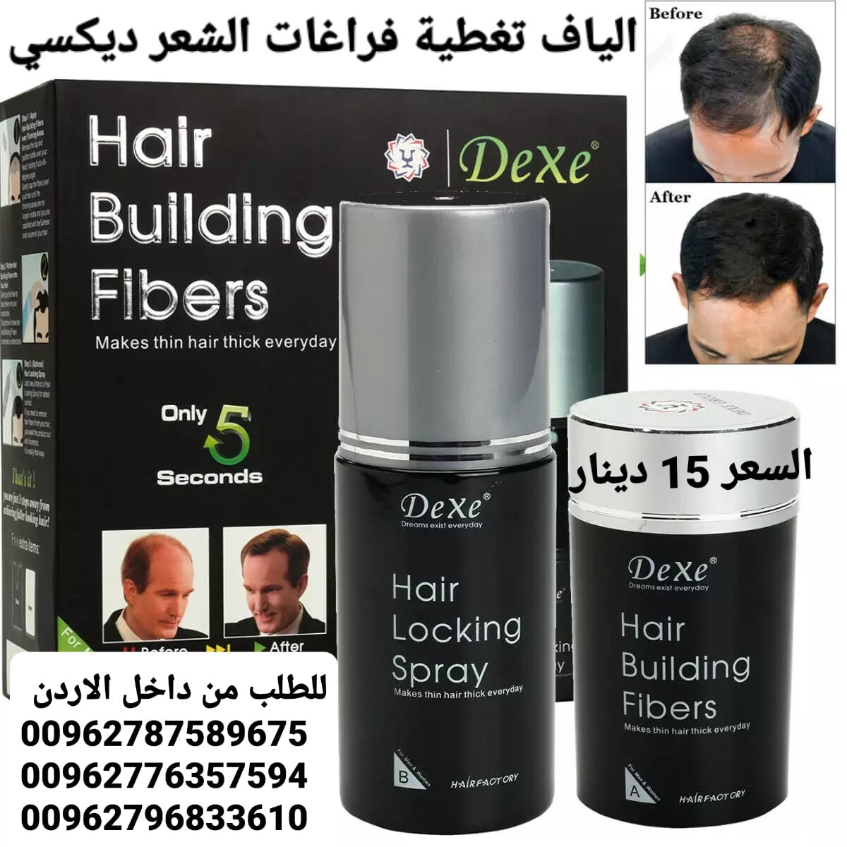 الياف تغطية فراغات الشعر الخفيف والصلع ديكسي عند الرجال والنساء