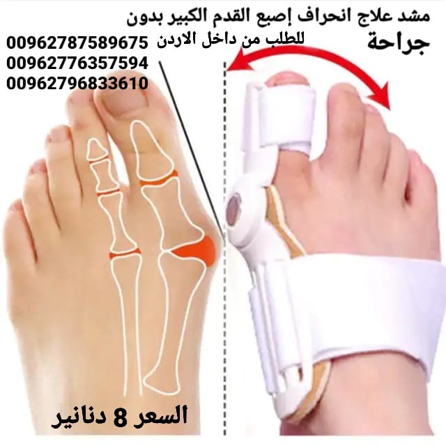 علاج بروز إبهام القدم بدون جراحة جهاز تقويم اصبع القدم الكبير .