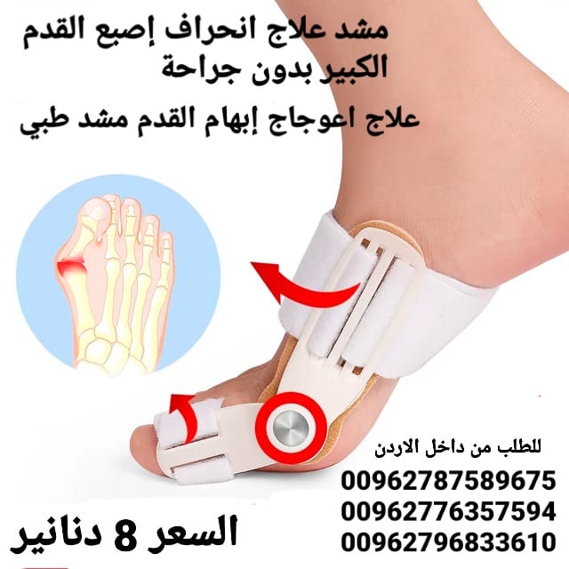 علاج بروز إبهام القدم بدون جراحة جهاز تقويم اصبع القدم الكبير .