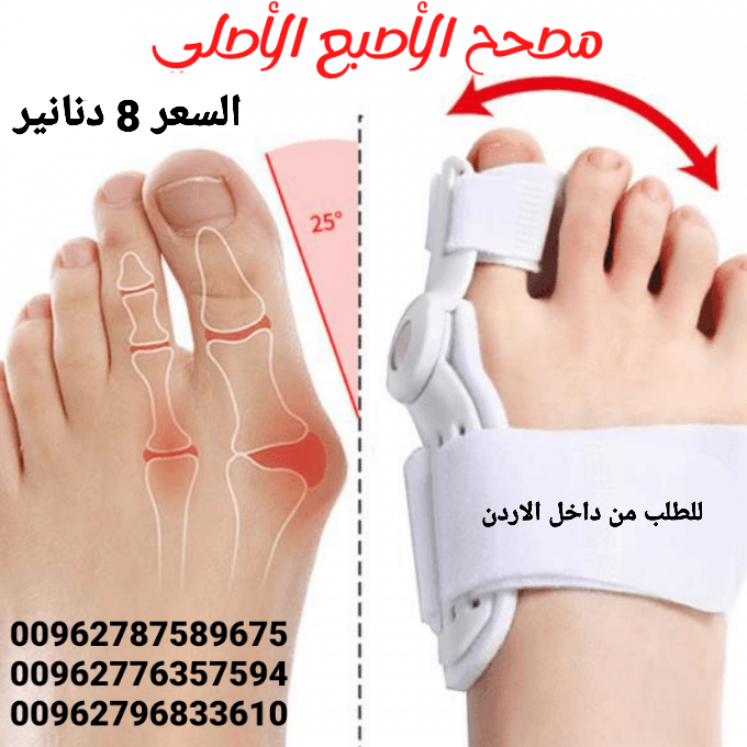 علاج بروز إبهام القدم بدون جراحة جهاز تقويم اصبع القدم الكبير .